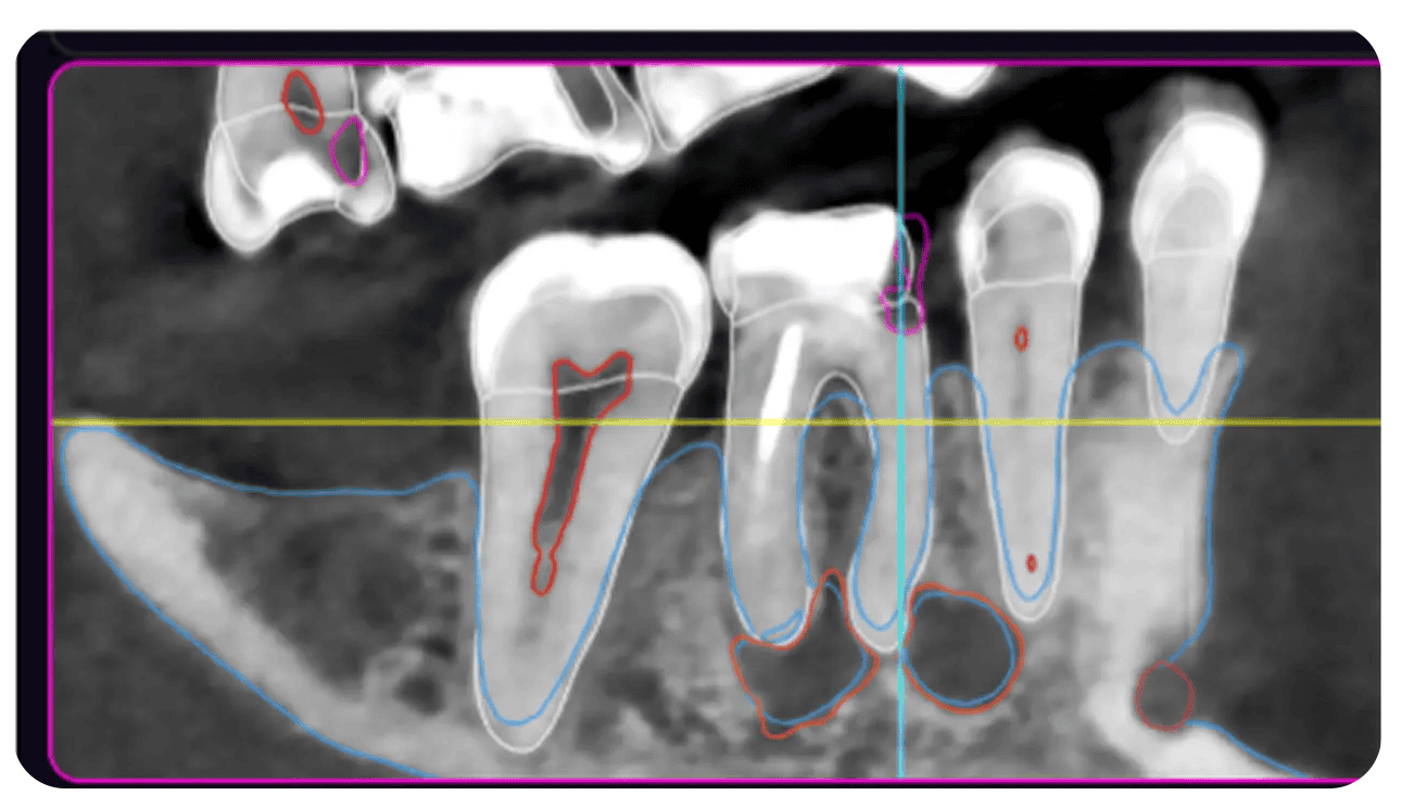 Screenshot 2025-06-11 at 13.55.22